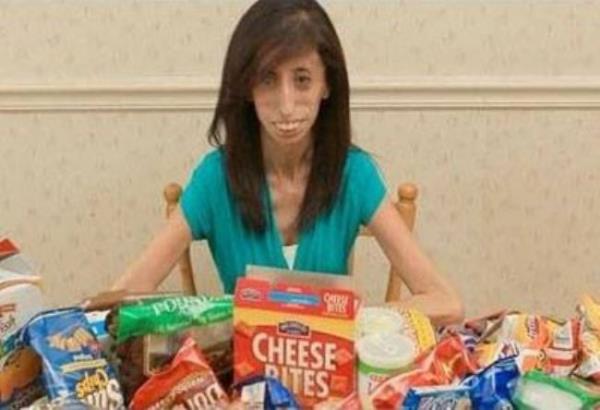 Lizzie Velazqxes Texas eyaletinin Austin ehrinde yayor. Ama hayatn devam ettirmesi iin 15 dakikada bir yemek yemek zorunda.