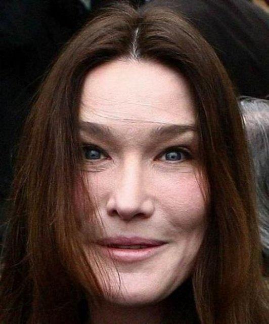 Carla Bruni'nin botokslu grnts.