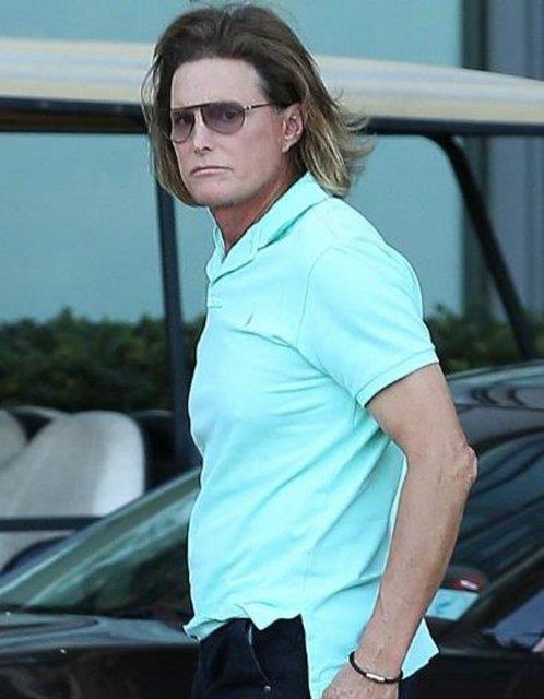 Bruce Jenner da botoks bamls. Geenlerde Adem elmasn bile kltrd.
