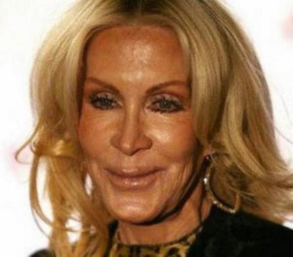 Joan Van Ark'n yz de byle tuhaf bir hale geldi.
