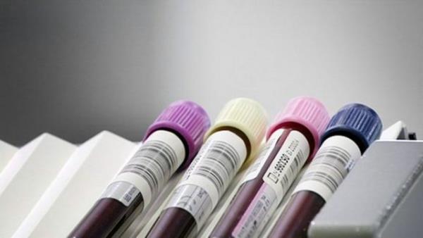 Finlandiya'daki Molekler Tp Enstits'nde grevli bilim insanlar, salkl bir kiinin be yl iinde herhangi bir salk sorunundan lme riskini belirleyen bir kan testi gelitirdi.