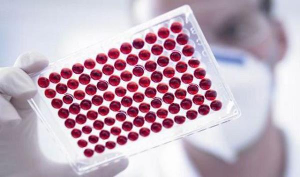 Basit bir kan testiyle, kanda bulunan molekllerden olan "biyobelirte" seviyesi llerek, risk belirleniyor.