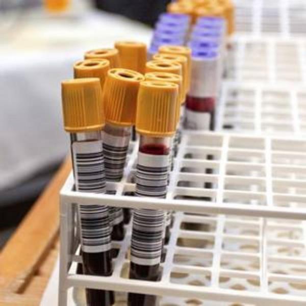 Be yl sreyle 17 bin kiinin verilerini incelediklerini syleyen Kettunen,