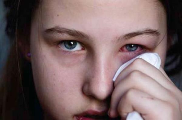 3- Gzde sulanma, kant, ar, okurken zorlanma, yazlarn birbirine karmas, gz ve ba ars olmas, ba eik tutarak okuma, gzleri ksarak bakma, odaklanma problemleri gz hastalklar belirtisidir.