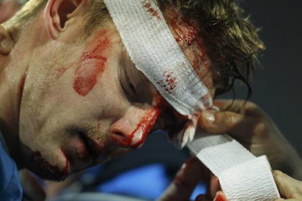 Zenit'in tecrbeli futbolcusu Tomas Hubocan, Dortmund'un golcs Lewandowski ile girdii bir pozisyonda yerden kalkamad.