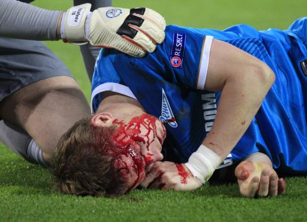 te Hubocan ve Valencia'nn yaad zc olaydan kareler...