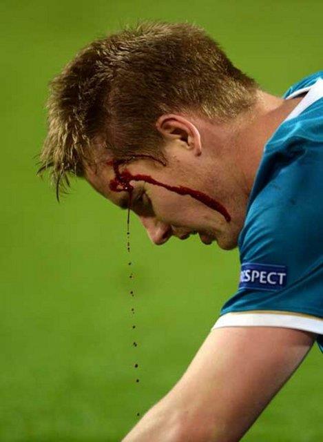 Zenit'in Dortmund'u 2-1 yenip turu geemedii mata Zenitli Tomas Hubocan, Lewandowski'nin mdahalesiyle kanlar iinde kald