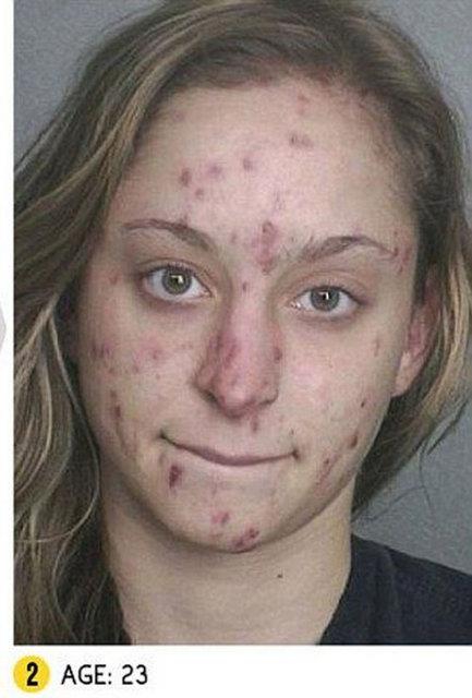 Son yakalanmasnda kokain, eroin ve oxycontin bamls olduunu syledi.