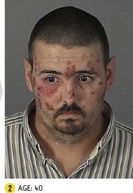 Gzaltna alnarak fotoraf ekildi. 6 yl sonra tekrar yakalandnda yz gz yaralarla kaplyd.