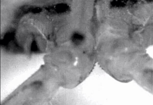 24. "Dilileri" insanlardan nce kullanmaya balayan bir bcek vardr