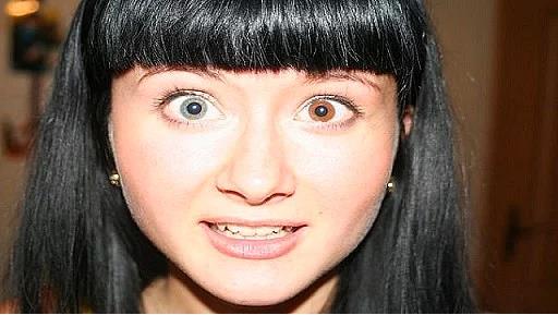 <p><b>4. Heterokrom</b></p>  ki gz de doutan farkl renklerde olan kiileri tanmlamak iin kullanlan terimdir.