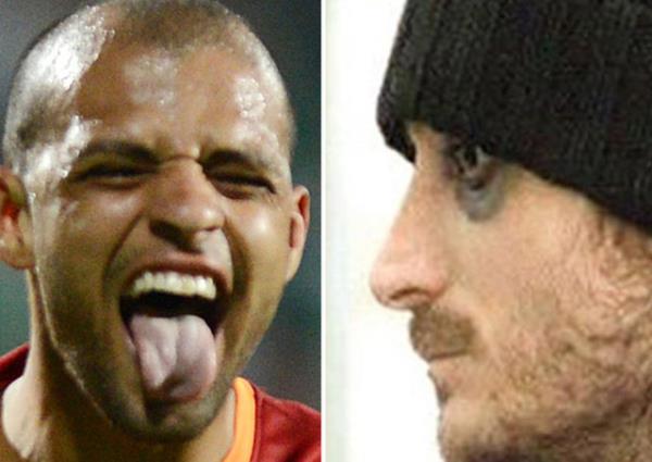 MELO - RERA (Galatasaray)