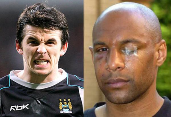 JOEY BARTON - O. DABO (Manchester City)