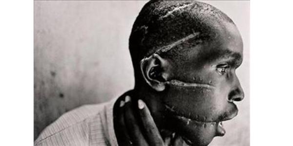 <p><b>1994 James Nachtwey, ABD</b></p>    Ruanda'da bu adam Tutsi isyanclaryla konutuu gerekesiyle askerler tarafndan bu hale getirildi...