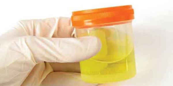 lm nedenleri arasnda yzde 20.7 olarak ilk sralarda yer alan kanserin, grlme hz binde 2.8 olarak kaytlara geti.