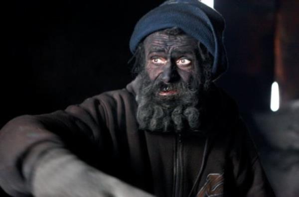 En son ne zaman ykandn hatrlamayan 58 yandaki kl adam hkmetten aylk 81 Euro yardm alyor...