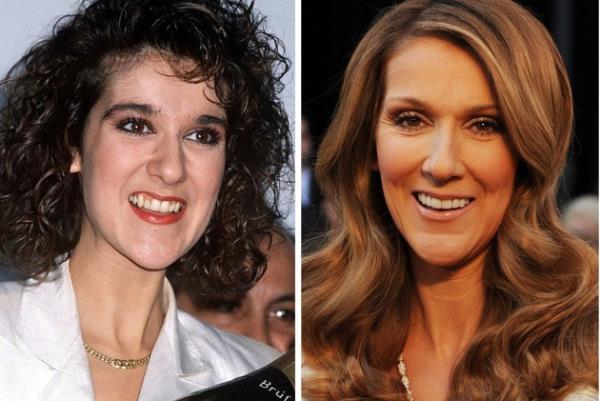 nllerin dileri nceden imdiki kadar mkemmel deildi...