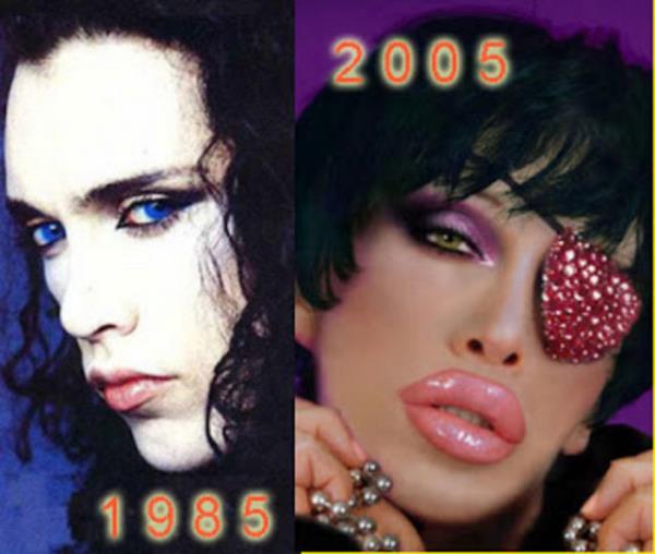 Pete Burns