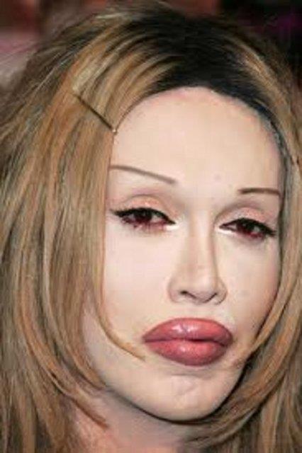 Pete Burns