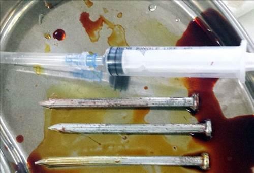 Bana aklan ivilerden 2 gn sonra haberdar olan adamn imdi sal gayet yerinde...