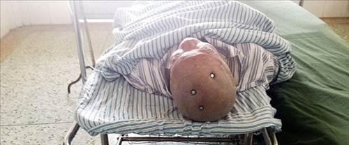 inli bir adam hastaneye getirildiinde bu grnts ile herkesi artt..