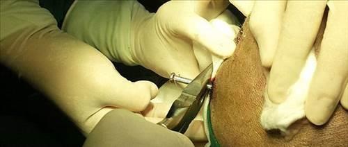 ivilerin hepsi karldktan sonra bir sre gzetim altnda tutulan adamn sal normale dnnce taburcu edildi...