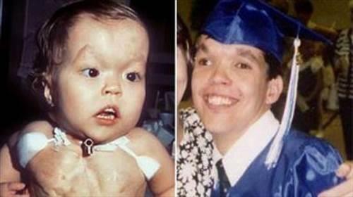 <p><b>KALB VCUDUNUN DIINDAYKEN...</b></p>         Christopher Wall kalbin gs boluunda bulunmamas durumunda en uzun sre hayatta kalan kii...