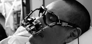 Szn ettiim aratrma ou az gelimi ve gelimekte olan 22 lkede yapld. Yaklak 14 bin inme geirmi hasta, 14 bin inme geirmemi kiiyle karlatrld.