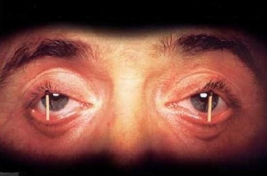 nsanlar kendilerine en yakn tr olan maymunlardan 3 saat daha az uyur.