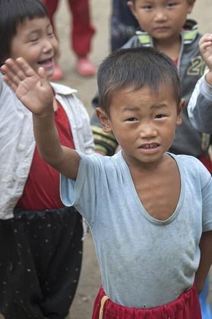Ordu, bu ocuk gibi kt beslenmi kiilerin fotoraflarnn ekilmesine izin vermiyor.