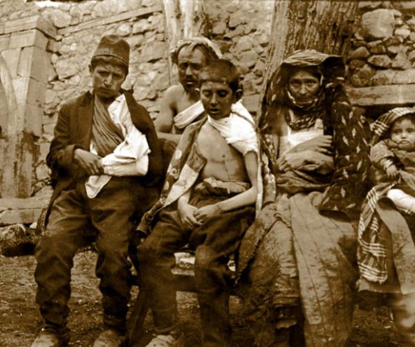 1912 Balkan Harbi'nin bug�ne dek g�n y�z�ne ��kmam�� �arp�c� foto�raflar�, sava��n en korkun� y�z� yeni bir kitapla ortaya konuldu