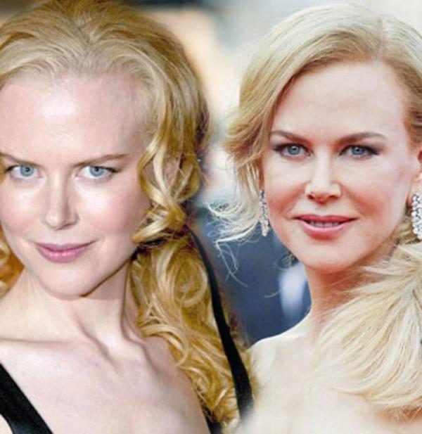 Nicole Kidman'n Cannes Film Festival'inde 10 sene nceki halinden bile gen durmas, grenleri artt. te 2004'ten bu yana genleen nller...
