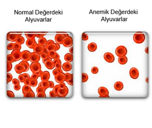 Kadnlarda, gebeliklerde ve ocuklarda daha sk grlr.