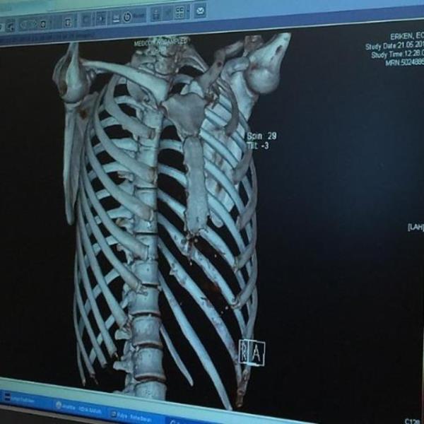 ECE ERKEN skeletim tp ne ilerledi arkada