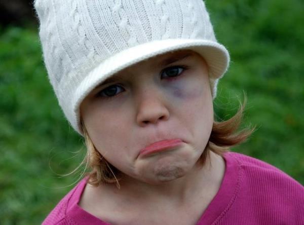 <p><b>TANIK OLANLARIN TEPKLER</b></p>  Kendim mdahale ederim %55.1