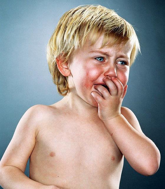 Sebepsiz alama %34.4