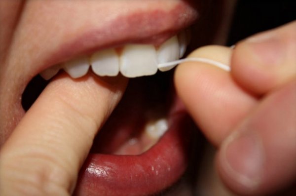 Di� ipi di�leriniz aras�nda kalan kal�nt�lar� k�rdandan daha iyi temizler ve plak olu�umuyla m�cadele eder.