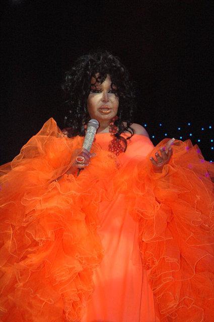 Bülent ersoy eski hali