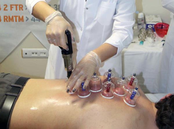 Kupa Tedavisi Hacamat 50-75 TL