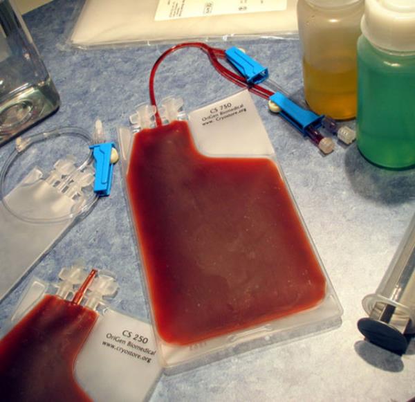 Kordon kanndan kk hcre nakli: 890 TL