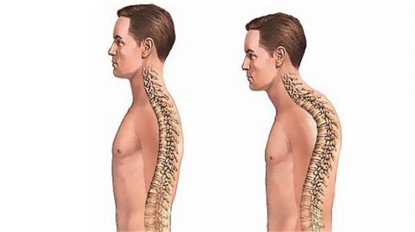 <p><b>Kambur durmak </b></p>    Eer iiniz btn gn oturmanz gerektiriyorsa, bu durumda otururken esnemenizi salayabilen koltuklar tercih etmelisiniz. Aksi halde uzun vadeli arlar, kirelenme ve eklem iltihaplanmalarna kar savunmaszsnz demektir.