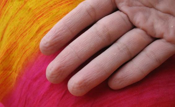 Parmaklarn suda burumasnn gerek nedeni