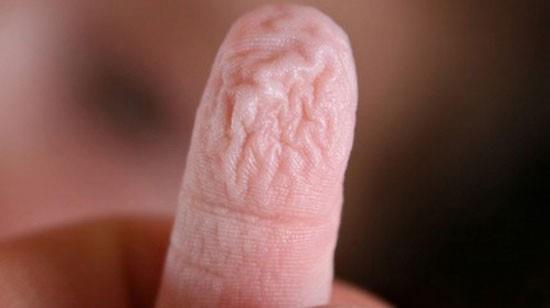 Suda uzun sre kaldnda parmaklarn burumasnn nedeninin, derinin snger gibi suyu ekmesinden ve tahrip olmasndan kaynakland dnlrd.