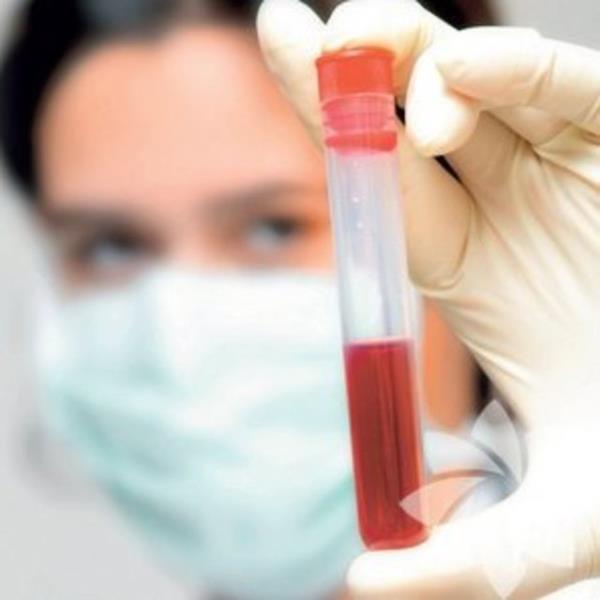 Demir krmz kan hcrelerinin yapsna itirak eder.Dokulara oksijen tanmasn salar.