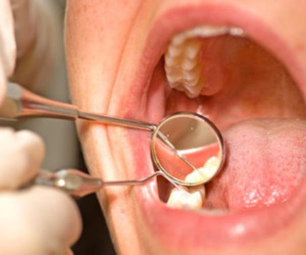 ouk dileri ine ile ekilirse bir daha kmaz