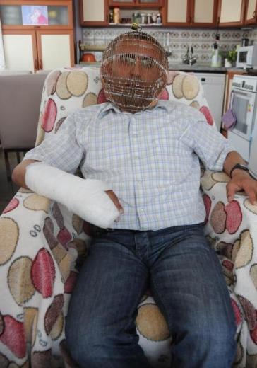 Geirdii bir kaza sonucunda elinden yaraland ve bu nedenle raporlu olduunu belirten Ycel, yle devam etti: