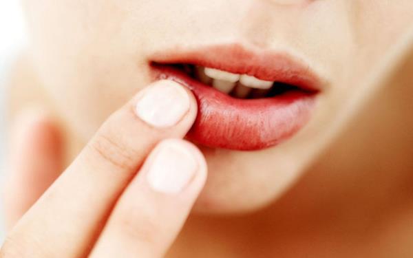 <br><b>UUK </b></br>  Azda ve genital blgede ortaya kan uuklar HIV?nin ilerlermi bir seviyede olduunu gsteren belirtiler arasnda yer alr