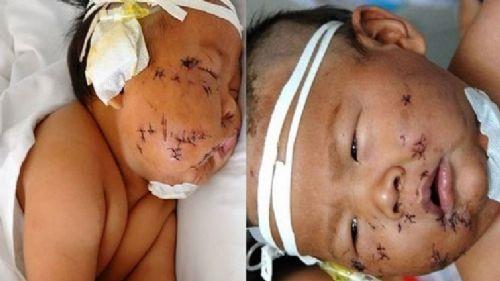 Kanlar iinde kalan Xiao Bao isimli bebek amcas tarafndan bulunuca hemen hastaneye kaldrld.