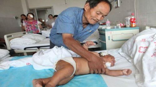 100'den fazla diki atlan zavall bebein tedavisi ise sryor.