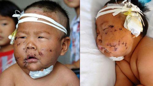 Dehete dren olayda annenin akli dengesinin yerinde olduu belirtildi